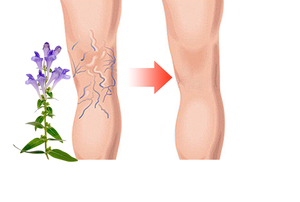 Günlük kullanım sodyum Aescinate bacak jeli-dolaşımını artırır, varisli ven semptomlarını (Heaviness, şişme) hafifletir, hızlı emici - Product Image 3