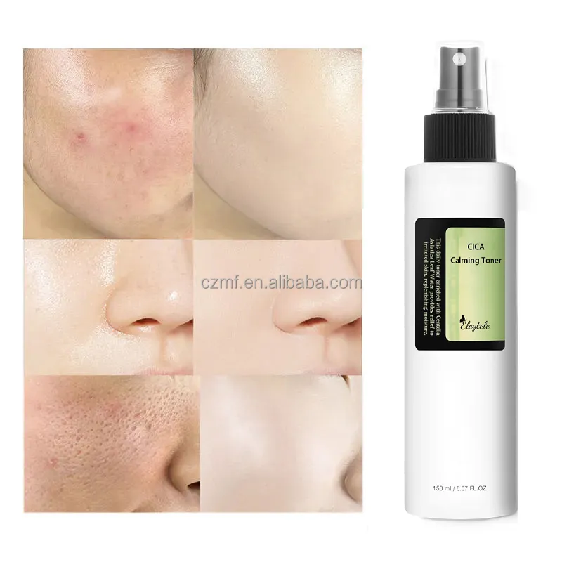 Cuidados com a pele personalizados do rosto do logotipo Niacinamide Hydrating Whitening Dark Spots Remoção Anti Acne Toner Facial Cica Toner para toda a pele