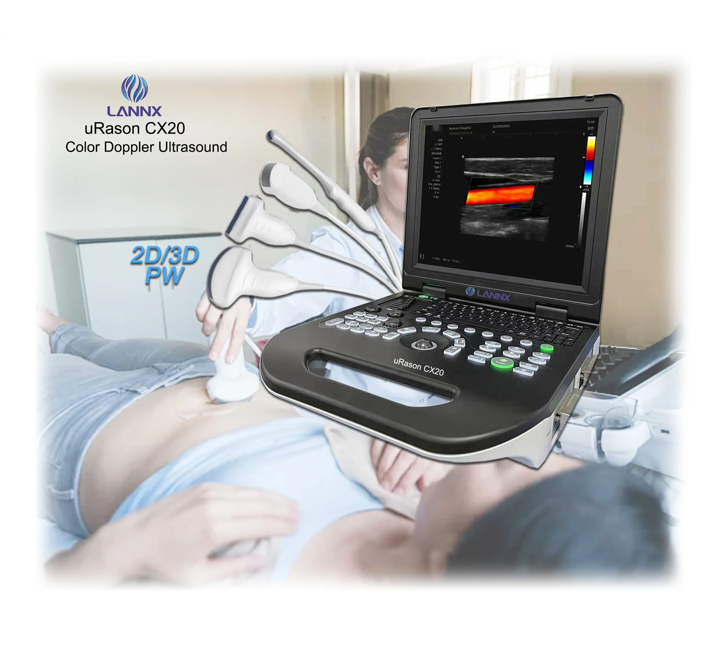 LANNX uRason CX20 Preço barato Médico Ultrasonic Diagnóstico 2D/3D opcional Instrumento PW Color Doppler ultrasound Machine