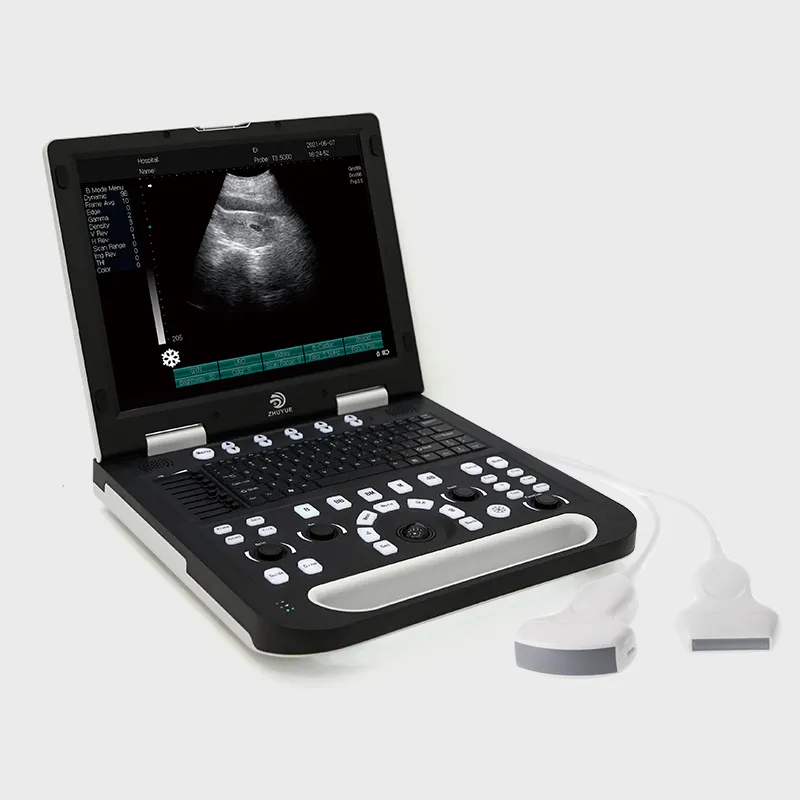 B-equipamento diagnóstico ultra-sônico portátil do ultra-som da máquina do ultra-som do doppler da cor costume do apoio