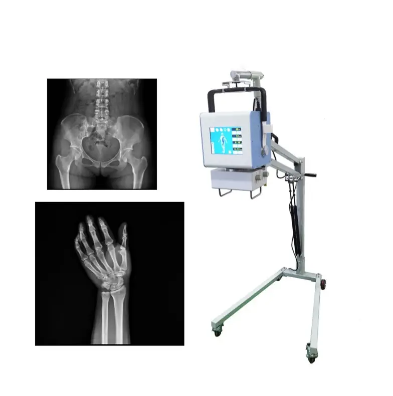 Alta frequência 5kw do veterinário humano panoramico móvel portátil x-ray digitizer x ray máquina digital preço