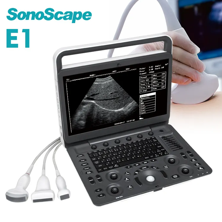 Sonoscape E1 E2 strumenti medici ad ultrasuoni 4d macchina ad ultrasuoni