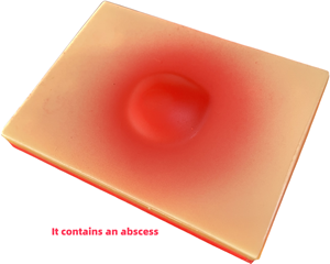 Piel realista de simulación médica de PVC para entrenamiento de incisión y drenaje de abscesos Entrenamiento de simulación médica para abscesos - Product Image 2
