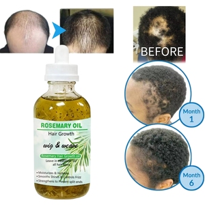 Organik anti-saç dökülmesi tedavisi biberiye saç büyüme yağı Serum hindistan cevizi yağı tabanlı zulüm-ev kullanımı için ücretsiz - Product Image 3