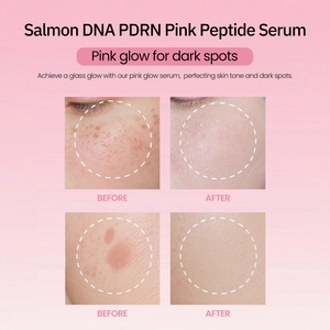 Oem ODM cá hồi DNA pdrn Hồng Peptide huyết thanh đốm đen điều chỉnh Niacinamide làm sáng Mặt huyết thanh - Product Image 2