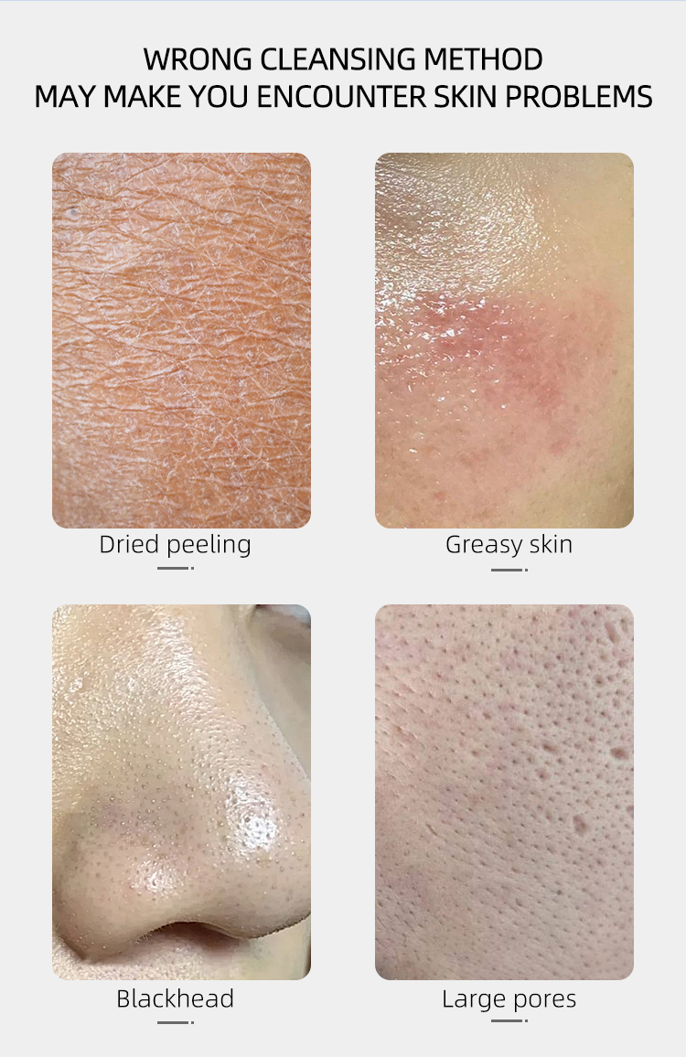 New Version 2021 Spray Wireless Charging Waterproof Ultrasonic Skin Scrubber