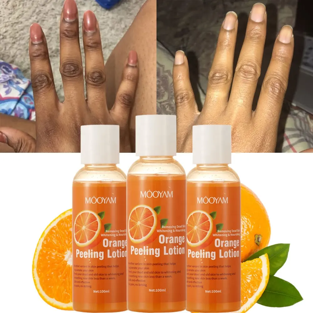 Effektivste Orange Peeling Lotion Private Label Körperpflege Haut aufhellung creme Öl Bio-Lotion zur Entfernung abgestorbener Haut