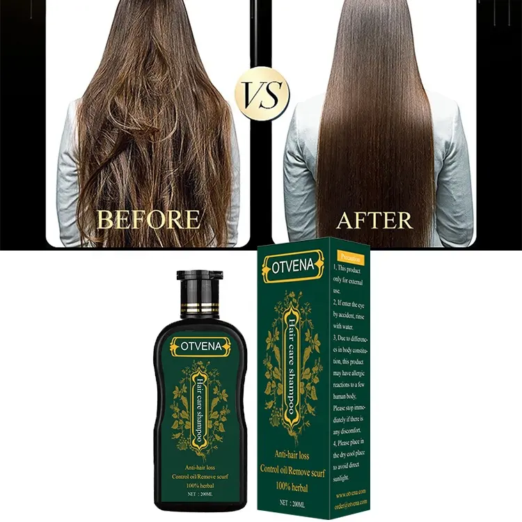 OEM Private Label Natural Gengibre Orgânico anti-perda de cabelo shampoo e condicionador