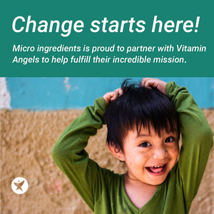 Multi-Vitale Eiwitten Collageen Peptiden Poeder Sachet Gehydrolyseerd Eiwit Hyaluronzuur Biotine Kruidensupplementen Voor Huidgewricht - Product Image 6