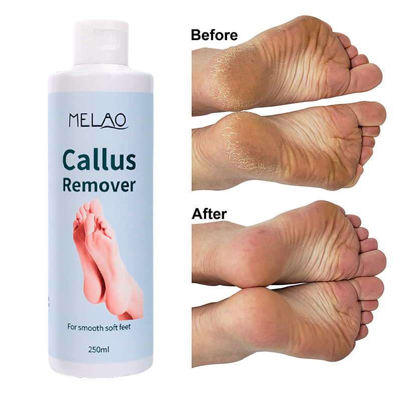 Foot Gel
