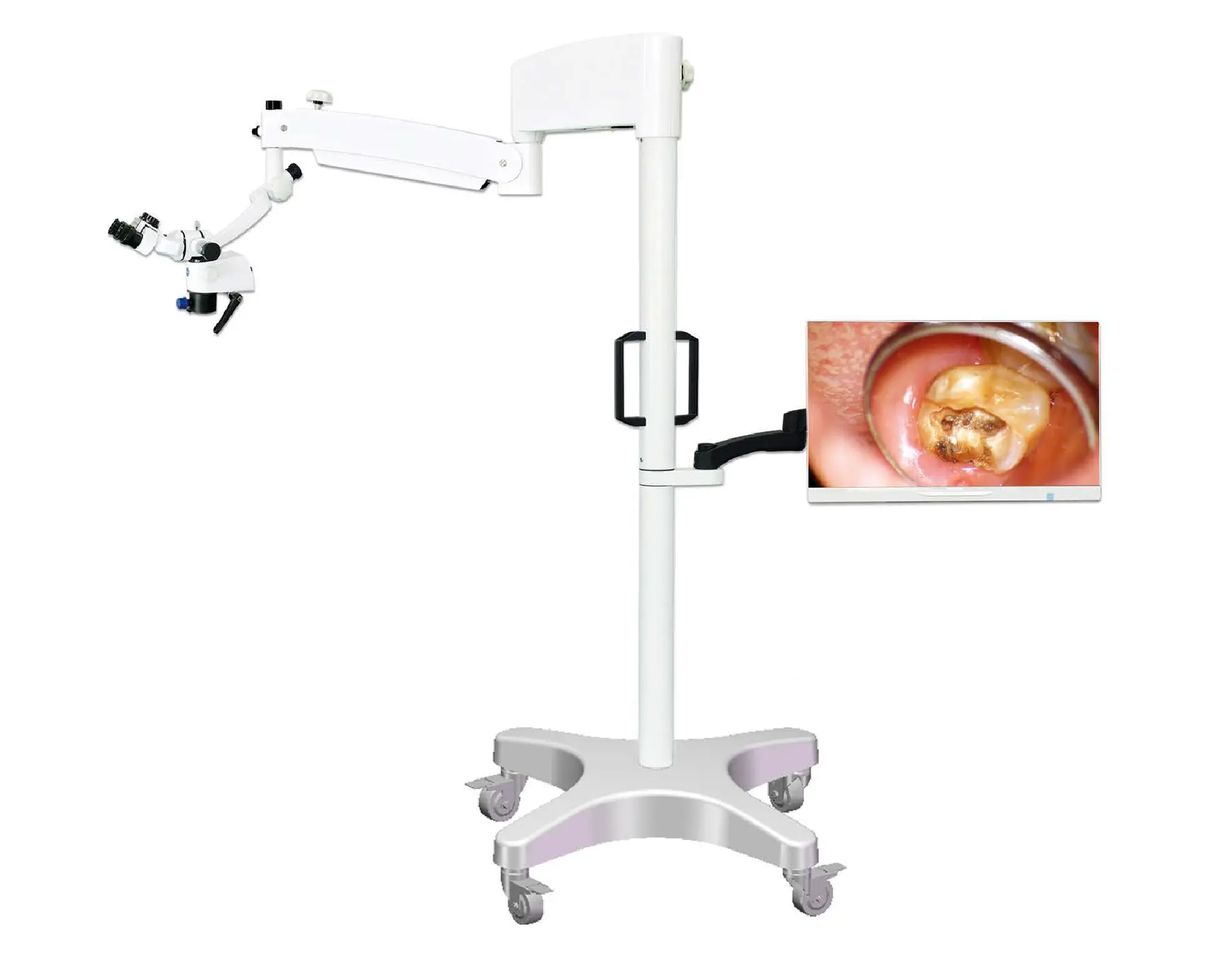 दंत ऑपरेटिंग माइक्रोस्कोप, सर्जिकल माइक्रोस्कोप दंत चिकित्सा, Endodontic माइक्रोस्कोप के साथ कैमरा