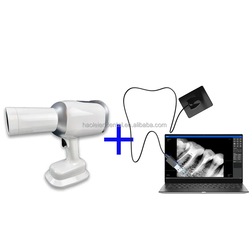 Unidad de máquina de rayos X Dental portátil de alta frecuencia Sensor DE RAYOS X Dental médico Conjunto DE RAYOS X Digital para la venta