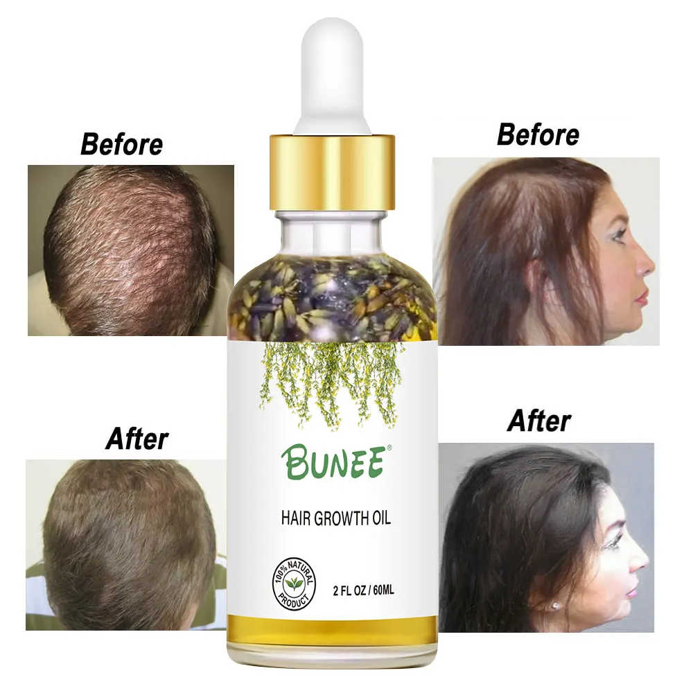 Óleo orgânico para cabelo, óleo anti-perda, tratamento de lavanda, para engrossar o cabelo, soro de óleo