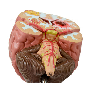 器官人体解剖学中风脑模型 - Product Image 3