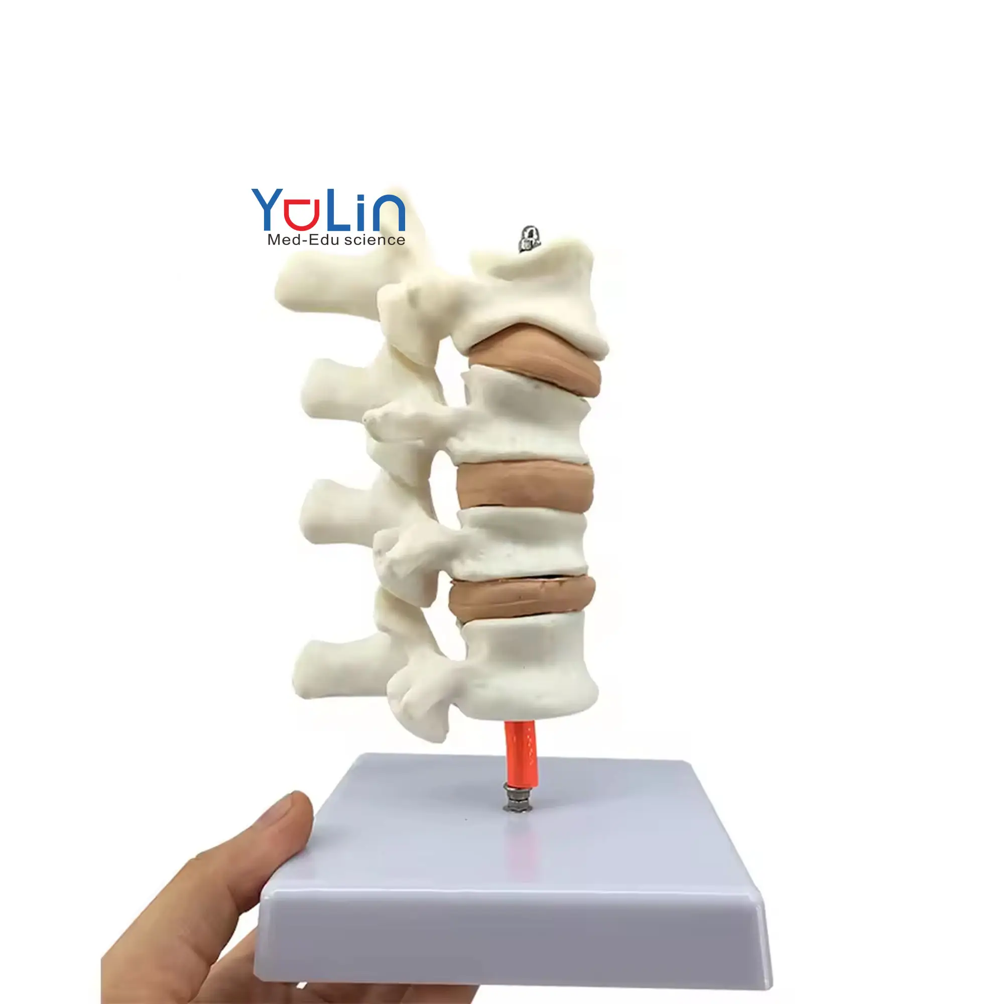 Ciências Médicas Vértebras Modelo De Lesão De Osteoporose Modelo De Esqueleto Humano Anatomia Articulação Vertebrae Lombar Modelo De Esqueleto Humano