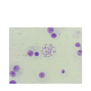 Normal insanın kromozomu. Slaytlar kadın erkek kromozom mikroskop genetik slaytlar DNA kromozomlar eğitim slaytlar - Product Image 4