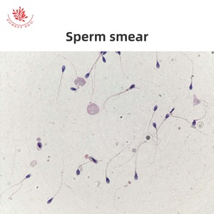 Von Menschen vorbereitete Histologie-Objektträger Hoden und Epidymis & Penis 6-teiliges Set - Product Image 6