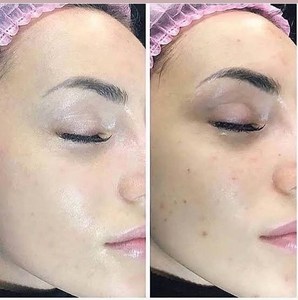 8ml Coreano <span class=keywords><strong>BB</strong></span> Creme de pele Brilho <span class=keywords><strong>Stayve</strong></span> <span class=keywords><strong>dermawhite</strong></span> ampola de Soro Brilho Para Acne Clareamento Anti-Envelhecimento <span class=keywords><strong>BB</strong></span> fundação creme - Product Image 6