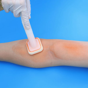 Tıbbi Test kitleri teşhis sarf malzemeleri için HCY OEM 26ml CHG cators katörler - Product Image 2