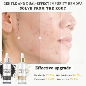 Gạo tùy chỉnh tẩy tế bào chết Ampoule Set-Nhẹ nhàng vỏ lỗ chân lông giảm thiểu hydrat hóa sâu đen trắng gạo cho sáng khuôn mặt phát sáng - Product Image 2