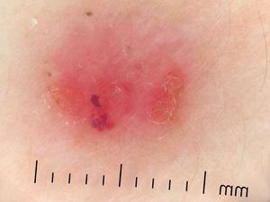 Дерматоскоп IBOOLO DE-400 с высоким увеличением, 10X, для кожи, кармана и смартфона - Product Image 5