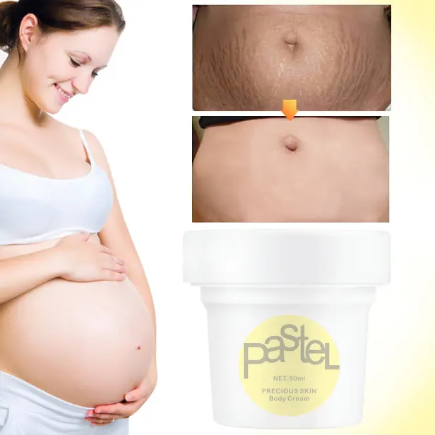 Wholesale OEM Skin Repair Anti Vergeture Organic Stretch Mark Removal Cream For Pregnancy Repair Anti Stretch Marks Cream