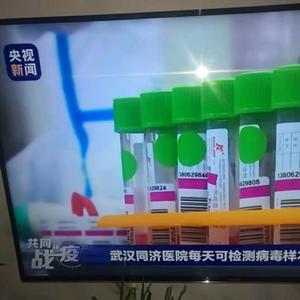 Örnekleri koleksiyonu set tüp ve akın çubukla oral burun swablar testi depolama - Product Image 2
