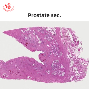 Von Menschen vorbereitete Histologie-Objektträger Hoden und Epidymis & Penis 6-teiliges Set - Product Image 5