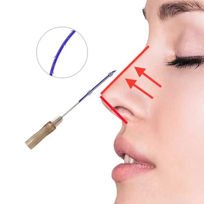 Korea medical PDO Nose Rhinoplasty Thread 19g 38mm/50mm/60mm for nose lifting