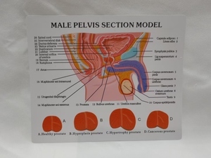 Human Male Abdominal Cavity Anatomical Model for Prostate &amp; Bladder Health Doctor Patient <strong>Explanation</strong> for Medical Teaching - Product Image 4