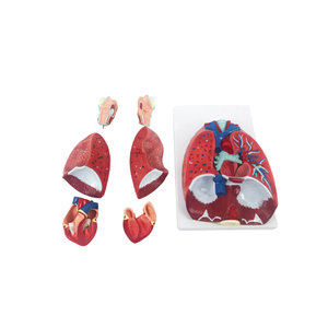 PVC Anatomical Model of <strong>Larynx</strong> Heart Lung for Medical Teaching &amp; Asthma Demonstration for Schools and Hospitals - Product Image 2