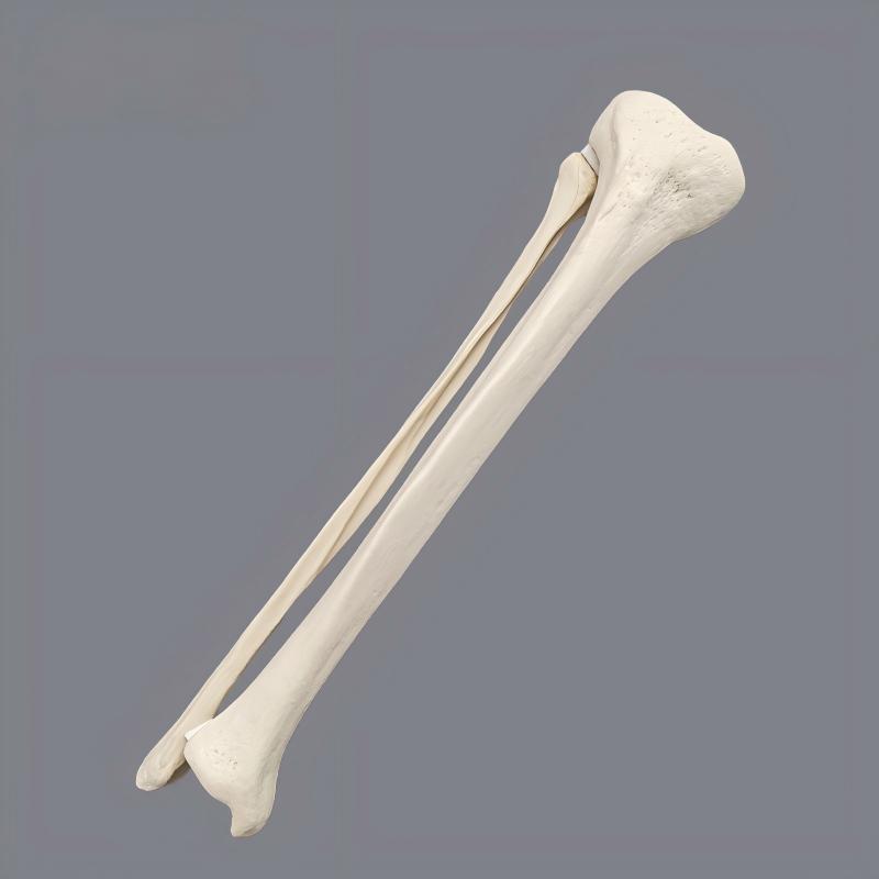 Tibia y peroné derecho