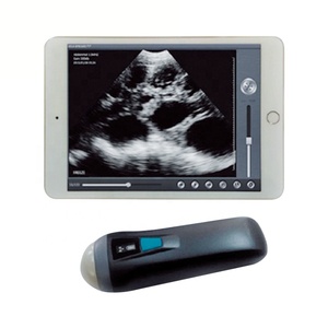 Machine à ultrasons vétérinaire Ecografo Portatil Veterinaria Handheld Mini Doppler couleur linéaire Wifi Scanner à ultrasons sans fil - Product Image 1