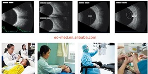 Newest Eye Equipment Digital Ophthalmic Scanner Machine With AB Scanner Box for Ophthalmology <strong>Application</strong> EUS500T - Product Image 6