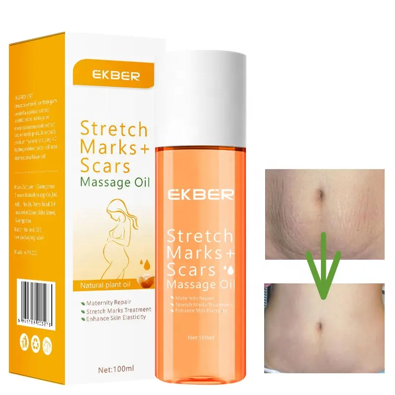 Private Label 100% olio biologico naturale per massaggi per il corpo riparazione della cicatrice rimozione delle smagliature olio d'oliva
