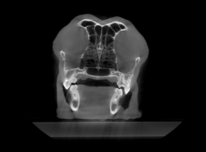 755 CT Sistema de tomografia computadorizada de 32 linhas Scanner CT médico