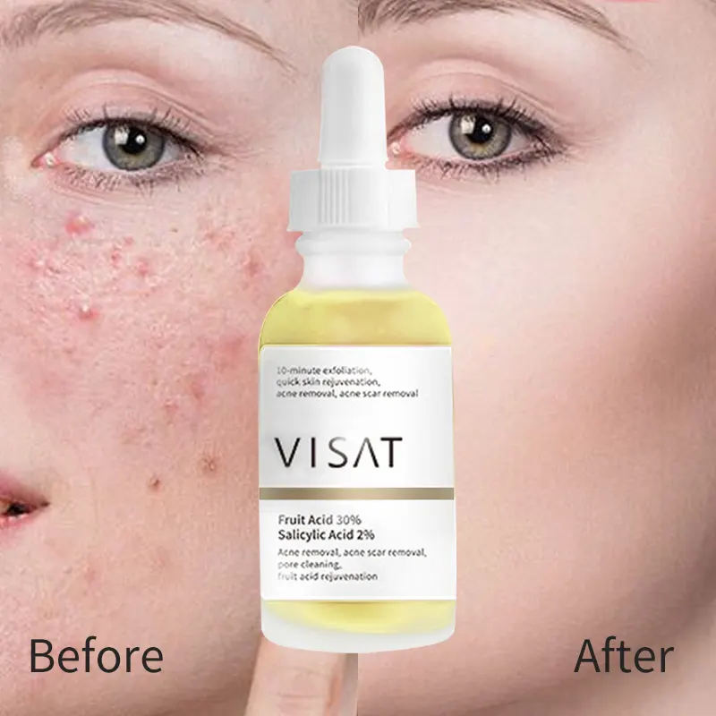 Personalizza Logo OEM Bulk Pure Natural Facial Whitening rassodante efficace siero per la rimozione della cicatrice siero per il trattamento dell'acne cura della pelle