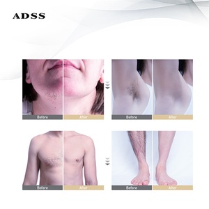 ADSS Laser Diode 4 gelombang 755 808 940 1064 Diode mesin Laser penghilang rambut untuk penghilang rambut Lazer permanen - Product Image 6