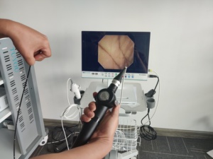 紧凑型柔性内窥镜摄像机全高清光源腹腔镜内窥镜记录系统