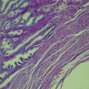 <strong>Microscope</strong> <strong>Slides</strong> <strong>of</strong> Pathology Prepared <strong>Slides</strong> <strong>Microscope</strong> Teaching Biology Science 100pcs Packed in <strong>Slide</strong> Box - Product Image 6