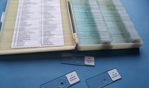 Teaching <strong>Microscope</strong> Human Pathology <strong>Slides</strong> (100pcs) - Product Image 6