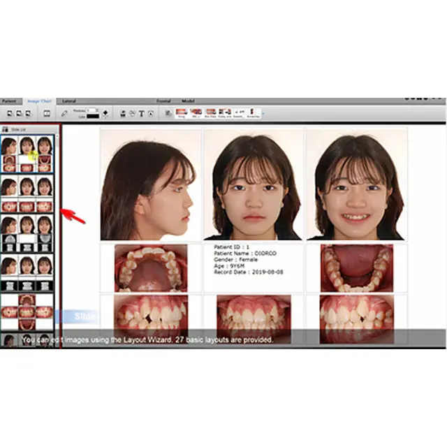 SmartCeph 2D cephalometric x-ray diagnosis by AUTOLIGN Korean High Quality orthodontic software manufacturer