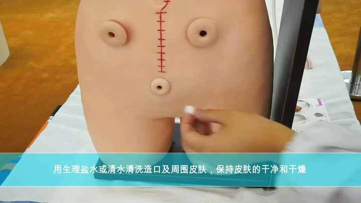 CE-zugelassenes zweiteiliges System Abtropf barer Stoma-Urin beutel  Urostomie-Abfluss beutel mit Hydrokolloid-Haut barriere