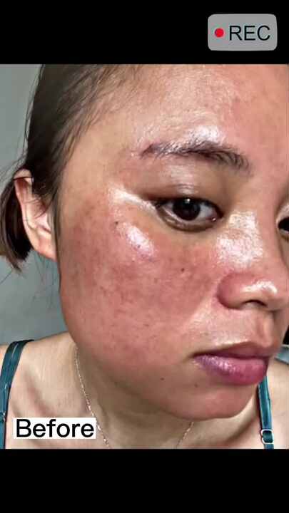 Glutathione White Cream Intensive Lightening Facial Cream with Glutathione  Vitamin C and Kojic Acid
