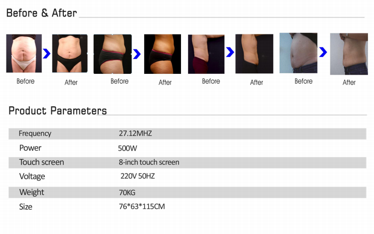 Newest Slimming Machine Belly Fat Reducing Non-Contact Body Sculpture Machine