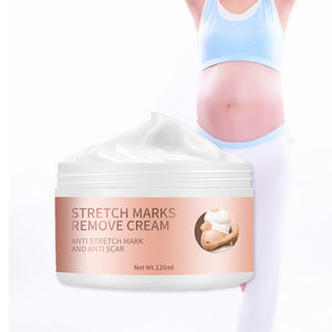 joy ointment for stretch marks