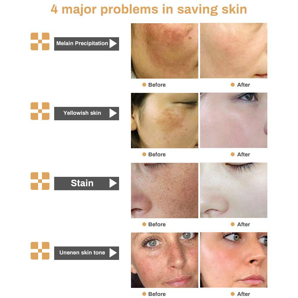 Factory Popular Organic Face Skin Care Moisturizing Whitening Cream China Plastic Bottle Private Label Adults Female 3 Years