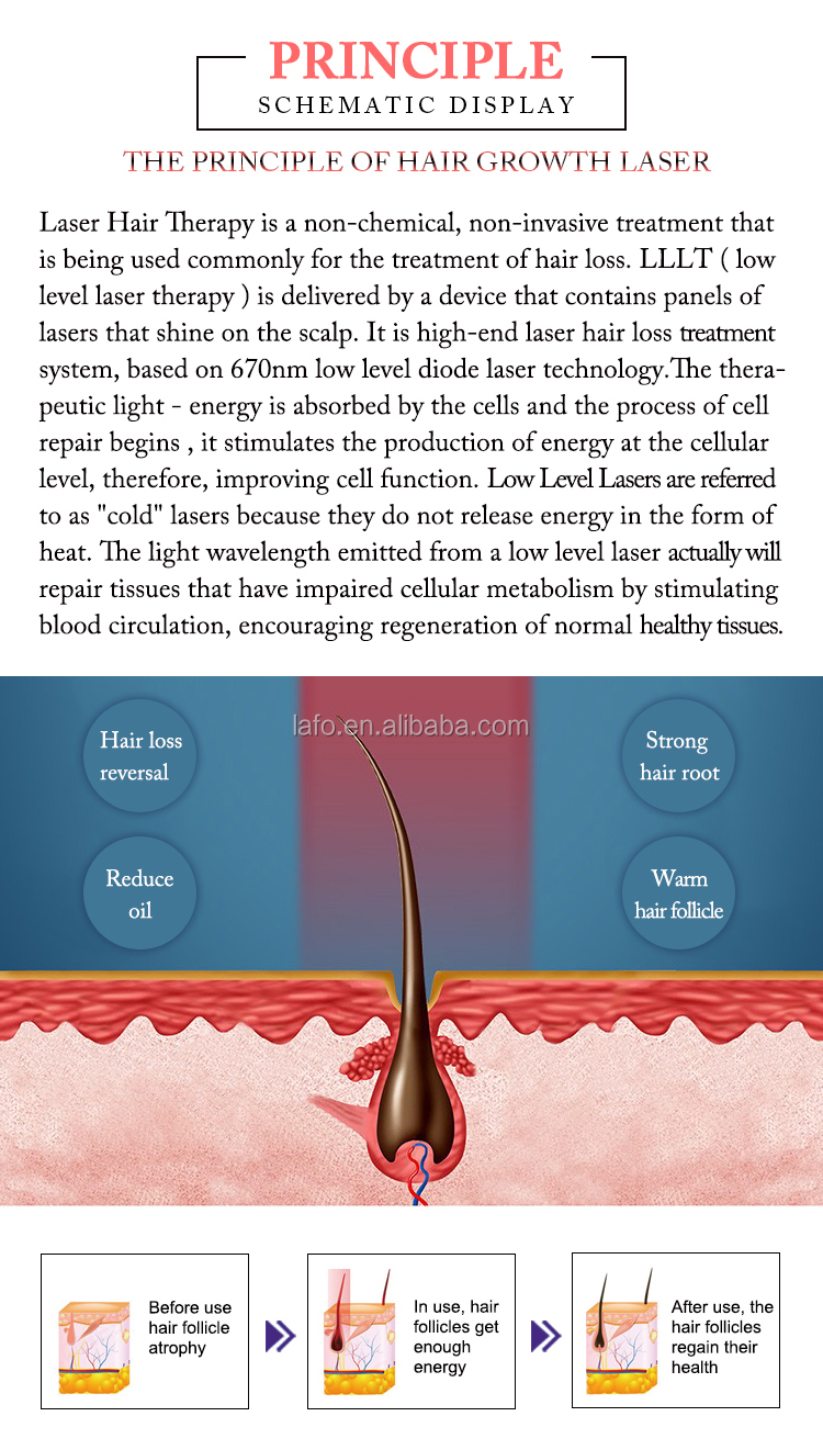 Effective 650nm diode laser hair regrowth treatment machine / anti-hair loss beauty machine LF-361