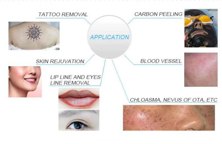 Picosecond tattoo removal machine