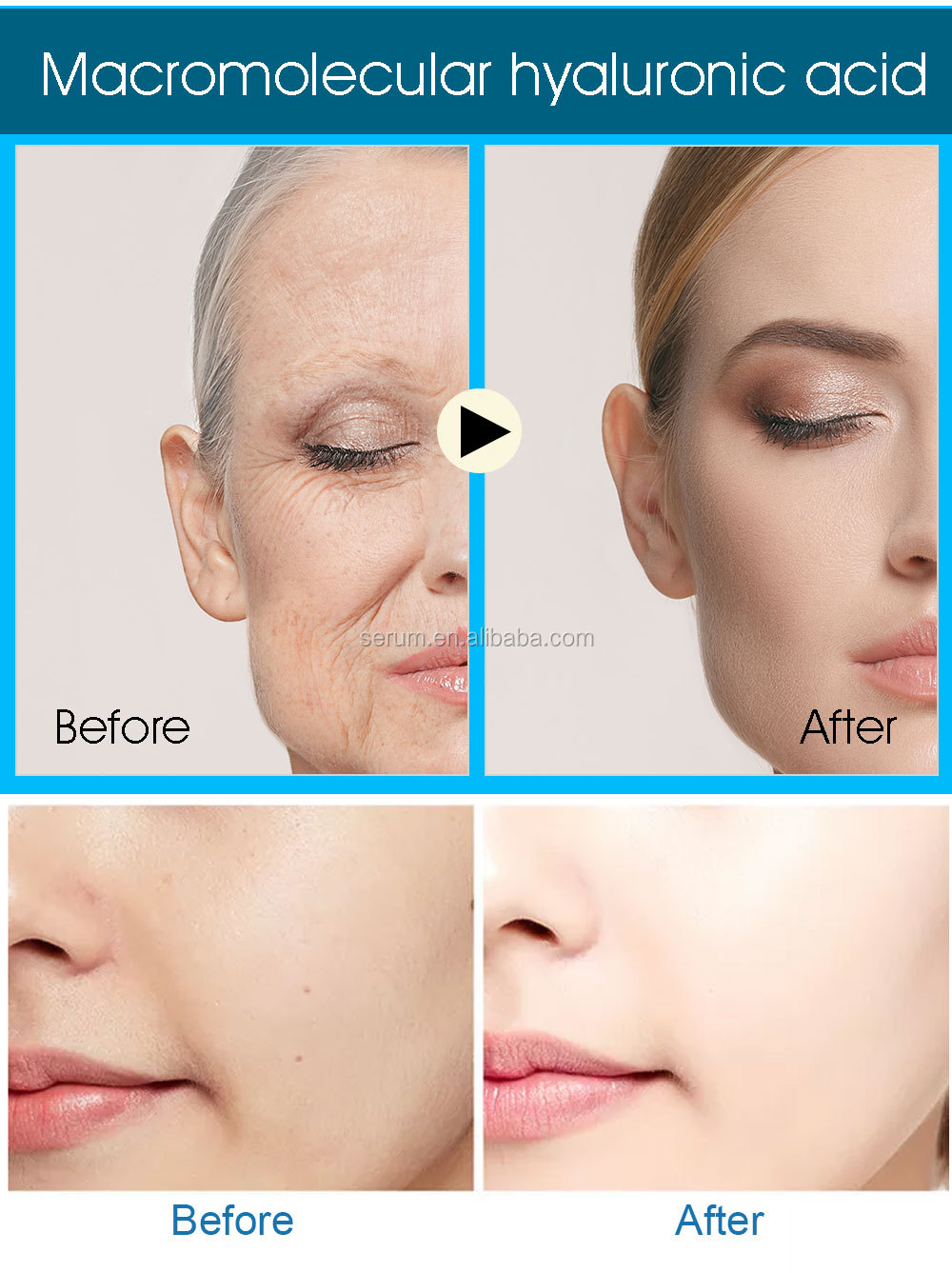 Custom Brand Hyaluronic Acid Serum For Skin Care Kojic Acid Serum Glutathione Plant Extract Whitening Serum